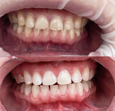 Улыбайтесь чаще! Стоматология «SMILE FOR YOU» дарит скидку до 40% Улыбайтесь чаще! Стоматология «SMILE FOR YOU» дарит скидку до 40%