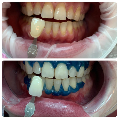 Улыбайтесь чаще! Стоматология «SMILE FOR YOU» дарит скидку до 40% Улыбайтесь чаще! Стоматология «SMILE FOR YOU» дарит скидку до 40%