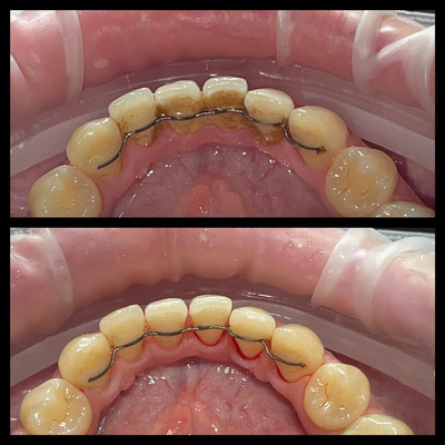 Улыбайтесь чаще! Стоматология «SMILE FOR YOU» дарит скидку до 40% Улыбайтесь чаще! Стоматология «SMILE FOR YOU» дарит скидку до 40%